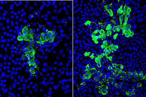 具有细胞核（蓝色）和SARS-CoV-2病毒感染的细胞（绿色）的人干细胞来源的气道组织模型的显微图像