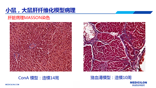 ConA和猪血清诱导的肝纤维化模型