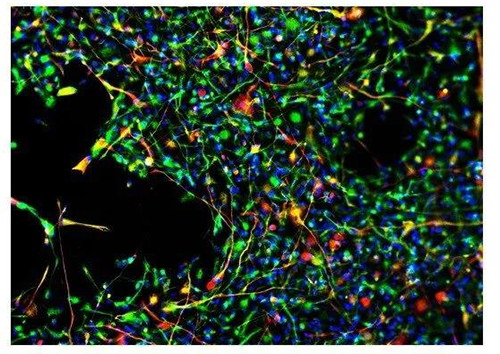 当神经退行性疾病的小鼠同时接受治疗性干细胞（红色）和药物SDV1a时，毒性细胞（绿色）消失