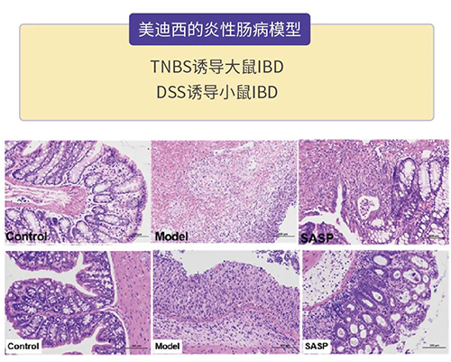 美迪西的炎症性肠病模型