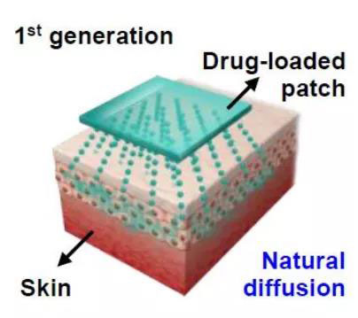第一代透皮给药技术：通过药物的自然扩散.jpg