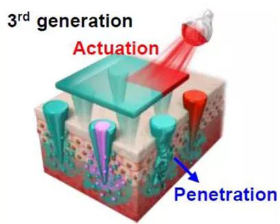 第三代：通过微针介导的皮肤层破坏和微针伴随的各种功能增强药物转运.jpg