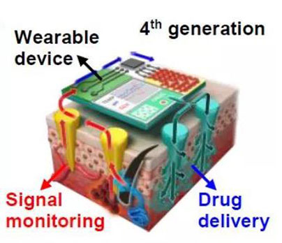 第四代透皮给药技术：在可穿戴设备的帮助下，用于患者定制治疗.jpg