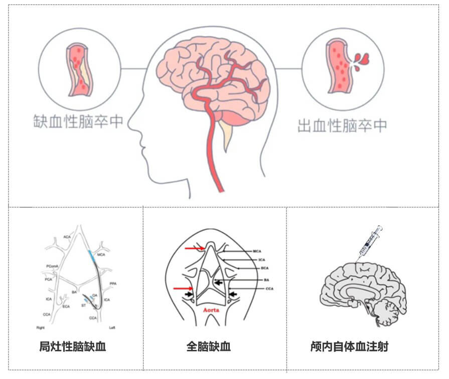 2-脑血管系统疾病.jpg