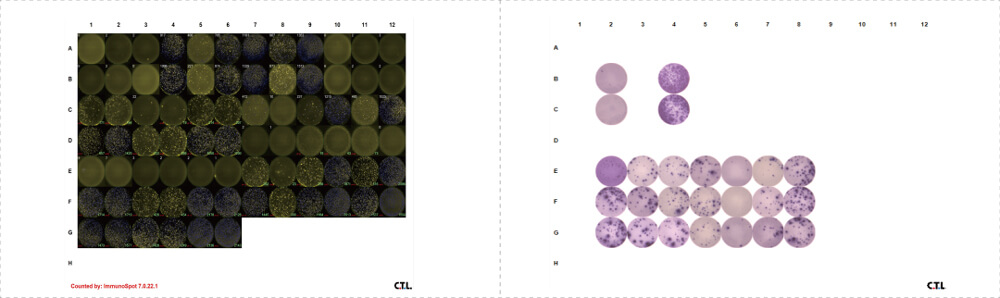 Data-shown-was-EliSpot-FluoroSpot-PBMC.jpg