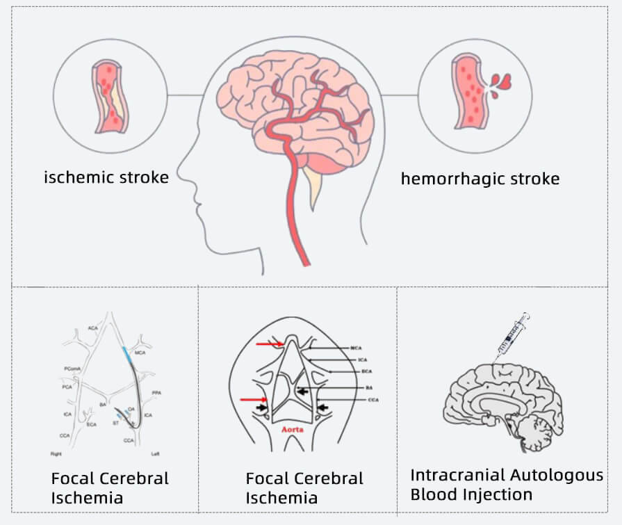 脑血管系统疾病常用啮齿类动物模型.jpg