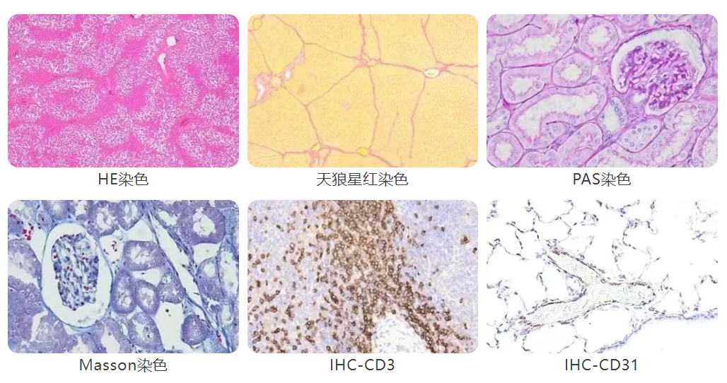 病理研究.webp