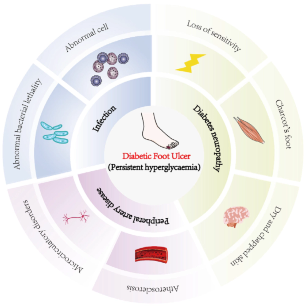 糖尿病足溃疡发病机制.webp 糖尿病足溃疡发病机制.webp