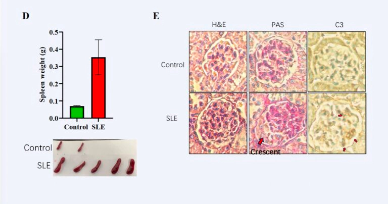 2 咪喹莫特 (IMQ) 诱发的 SLE（系统性红斑狼疮）-2.webp
