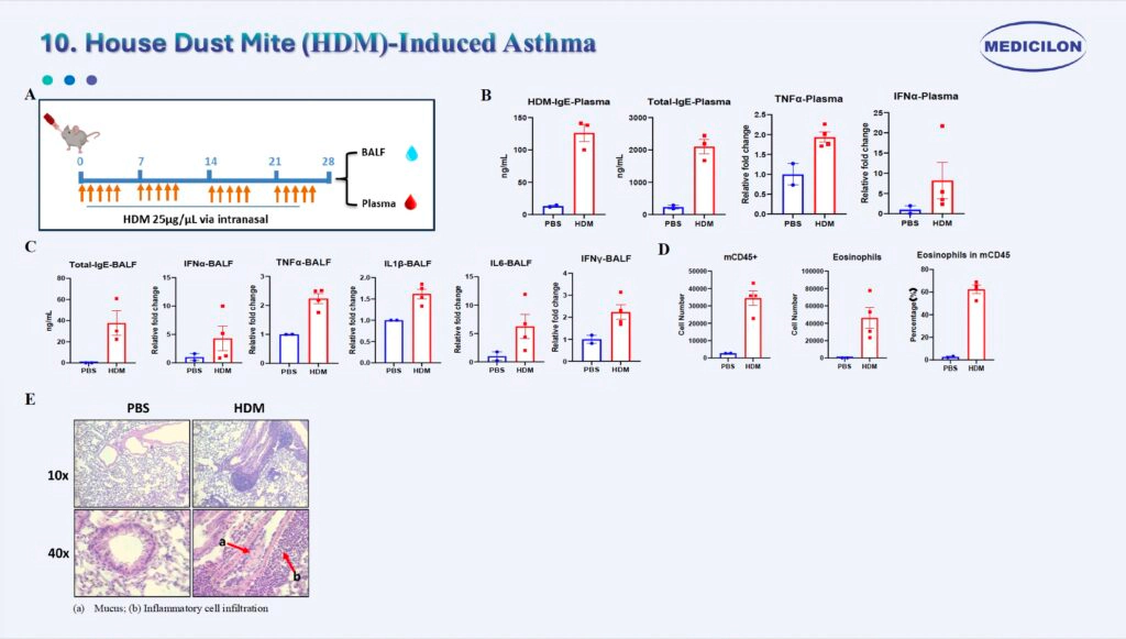 10 屋尘螨（HDM）诱发的哮喘.webp