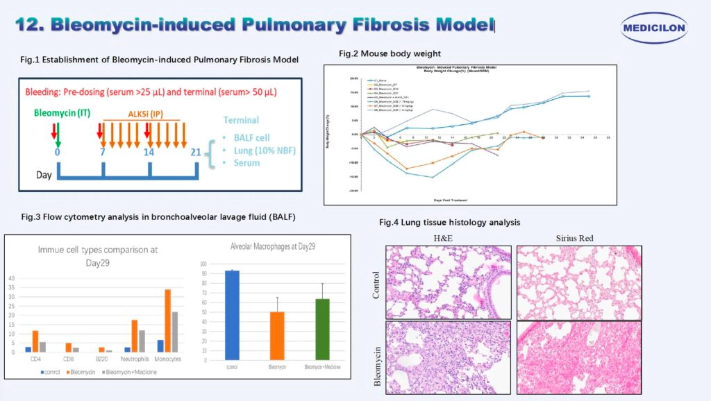 12 博来霉素诱导的肺纤维化模型.webp