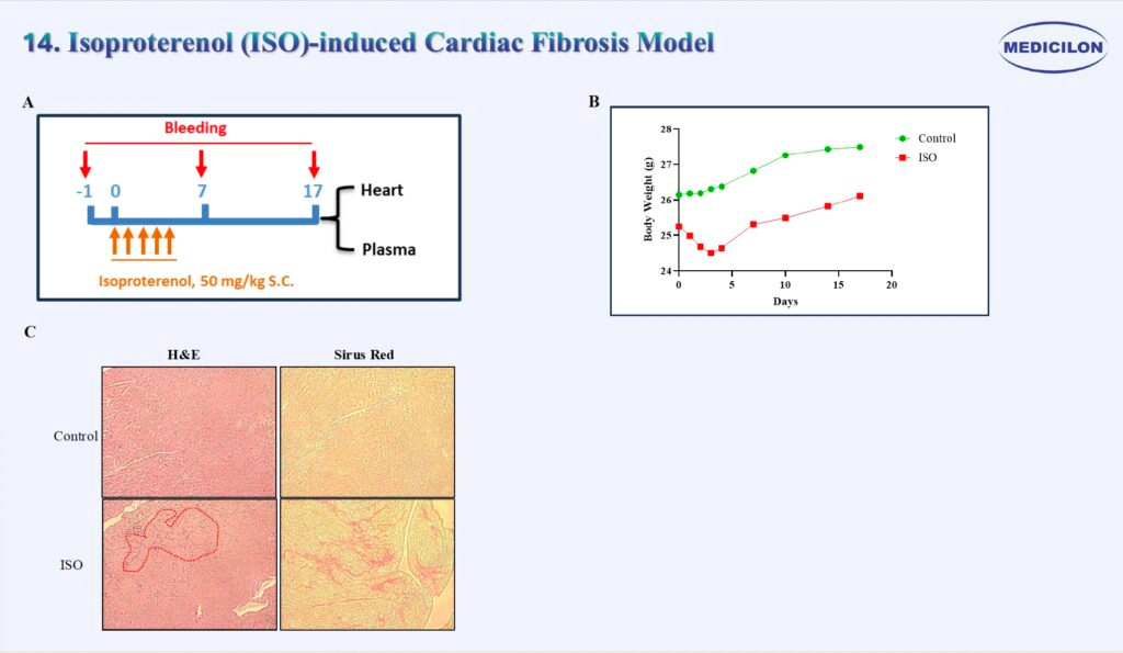 14 异丙肾上腺素（ISO）诱导的心脏纤维化模型.webp