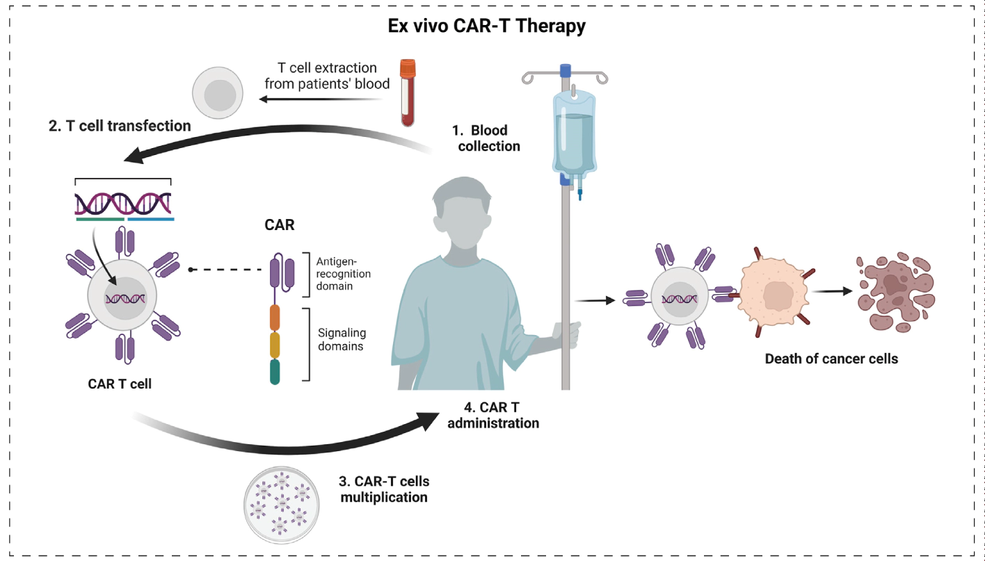 体外CAR-T细胞疗法的流程.webp