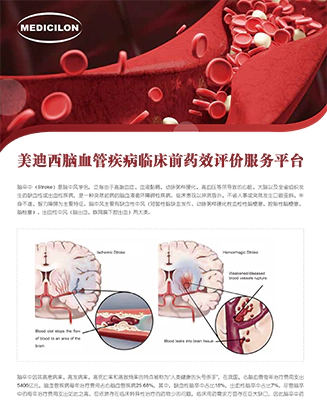 美迪西脑血管疾病临床前药效评价服务平台